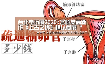 台北电玩展2020:宫崎英高新作《上古之环》确认参展“开云下载”(图3) 开云APP